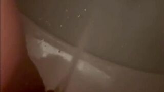 Huge piss complication