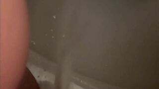Huge piss complication